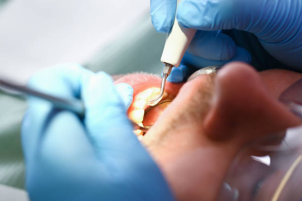 Professional Emergency Dental Service in IL